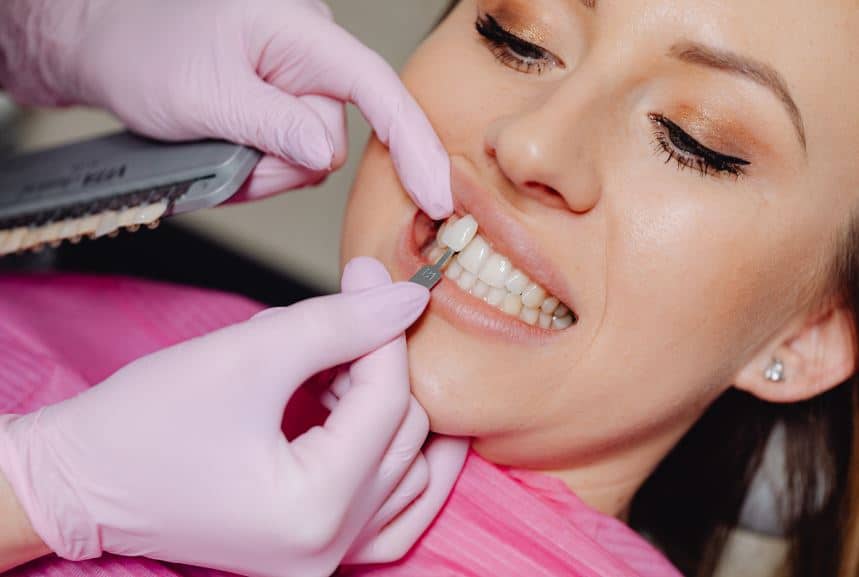 Veneer Procedure Your Detailed Guide to the Process of Getting Veneers