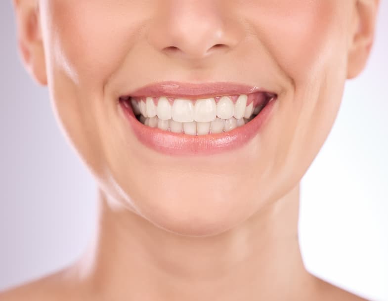 Smiling woman's white teeth close up photo