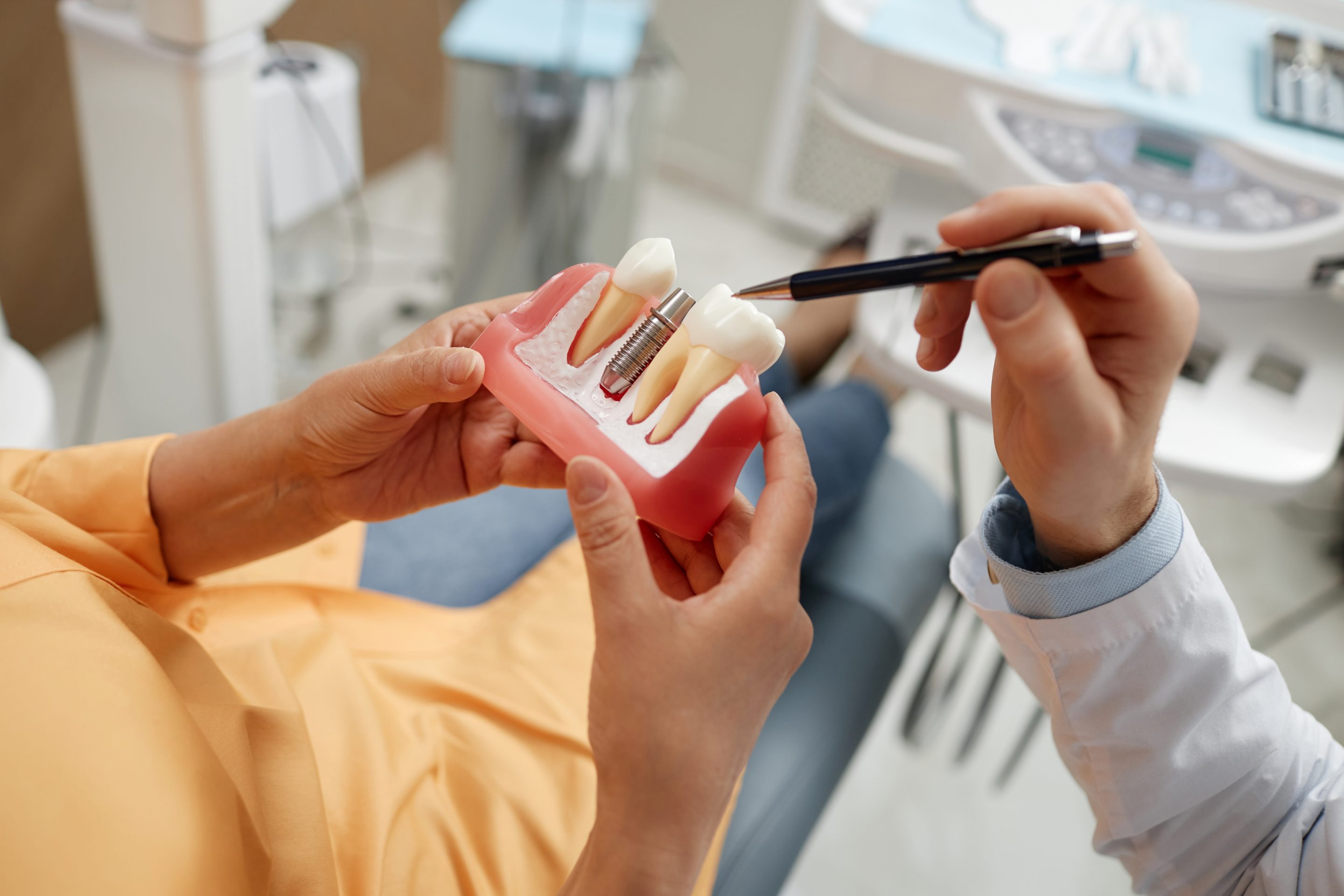 Dental Implant Model education in Foothill Ranch