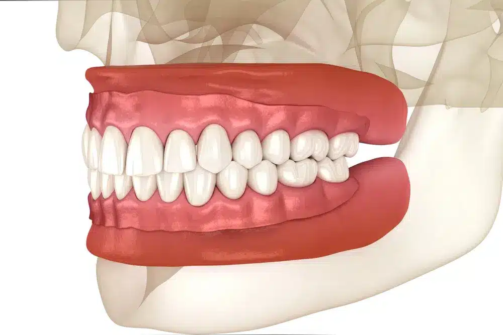 3D model of human teeth and gums