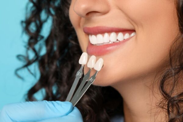 Smiling woman with dental veneer in Lake Forest, California.