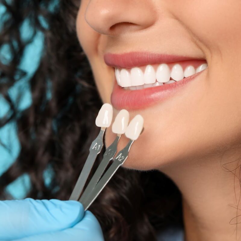 Smiling woman with dental veneer in Lake Forest, California.