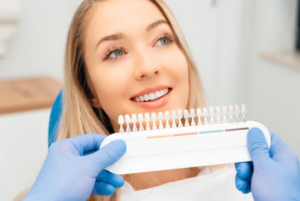 Woman getting teeth color-matched at dentist.